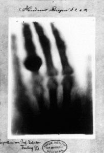 First_medical_X-ray_by_Wilhelm_Röntgen_of_his_wife_Anna_Bertha_Ludwigs_hand_-_18951222